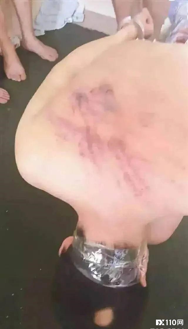 从缅北逃回来的人，亲述缅北发财噩梦！