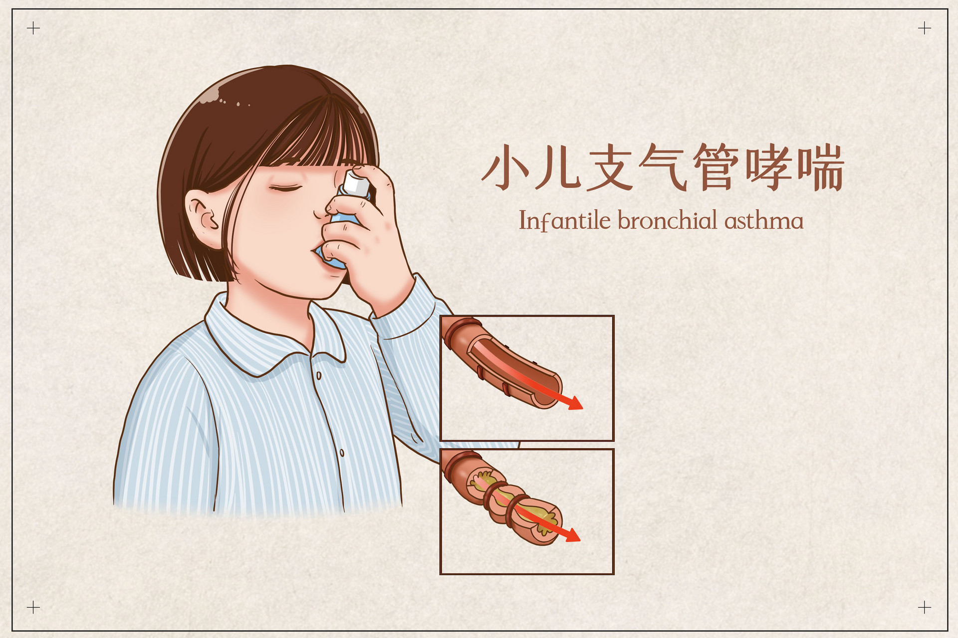 深圳有哮喘的孩子可以打新冠疫苗吗