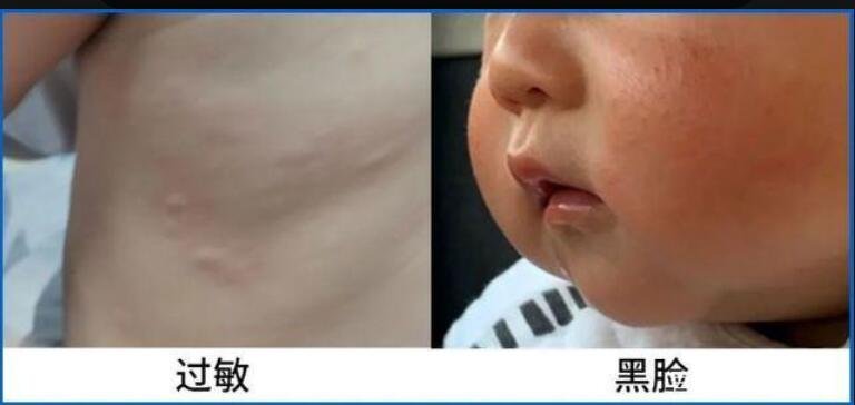 16款儿童面霜评测，儿童面霜怎么进行选择？宝宝皮肤护理注意事项有哪些？