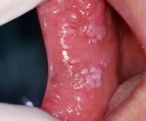 微软将推出AI版必应搜索 采用ChatGPT爆红技术:天天消息